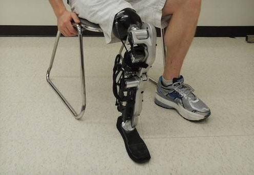 假肢價(jià)格要從哪幾個(gè)方面判斷(圖1) 假肢價(jià)格要從哪幾個(gè)方面判斷