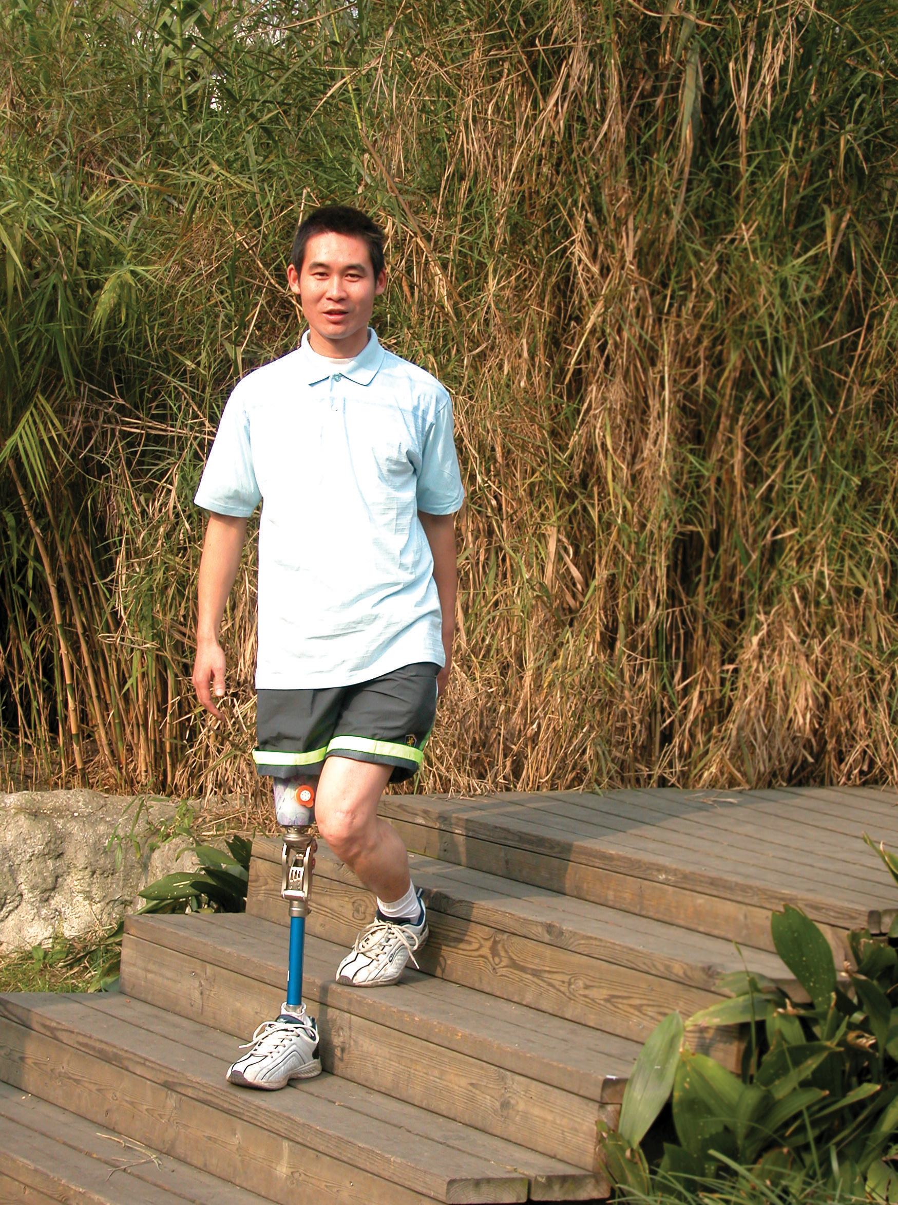 假肢價(jià)格便宜的可以選擇嗎?(圖1) 假肢價(jià)格便宜的可以選擇嗎?